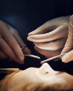 Rhinoplasty